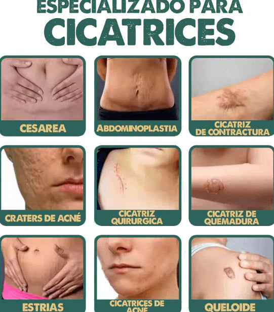 CicatriFix Regenera, suaviza y borra marcas y cicatrices