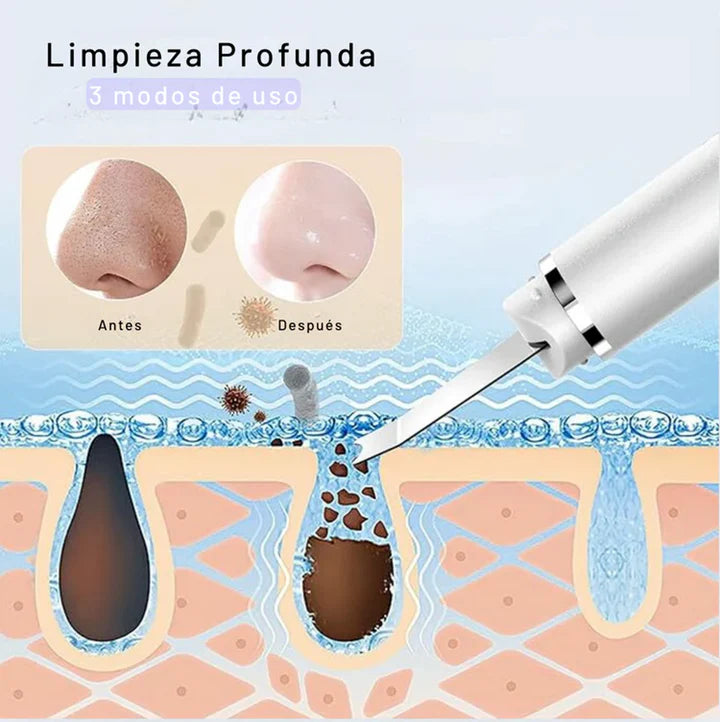 ESPÁTULA ULTRASONICA FACIAL ELIMINA PUNTOS NEGROS
