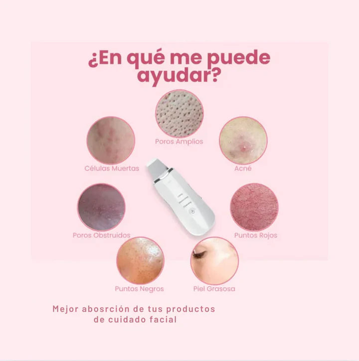 ESPÁTULA ULTRASONICA FACIAL ELIMINA PUNTOS NEGROS