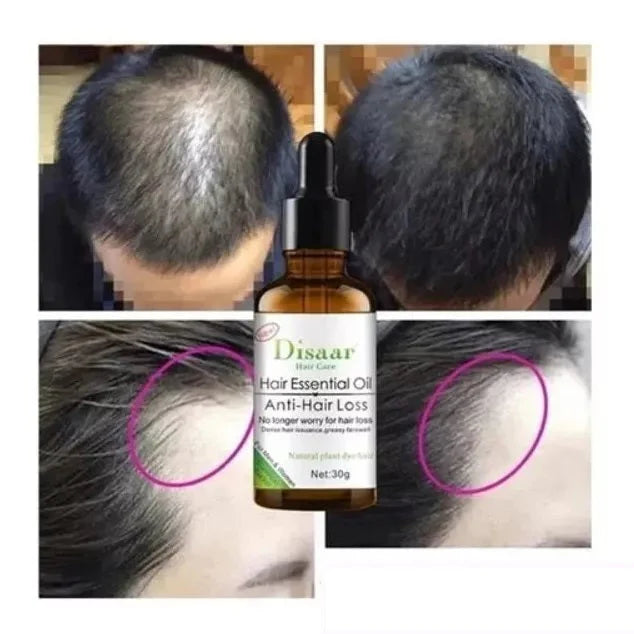 KIT COMPLETO DE ANTICAÍDA DE CABELLO (SERUM + SHAMPOO + CEPILLO MASAJEADOR)