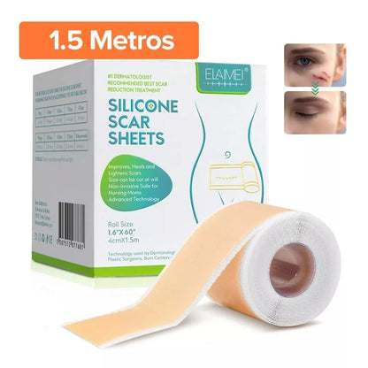 SILICONA PARA CICATRICES
