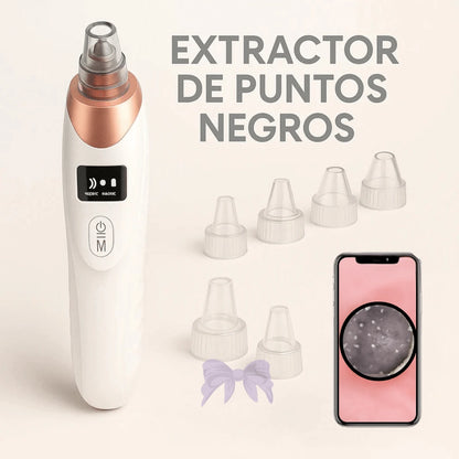 EXTRACTOR PROFESIONAL DE IMPUREZAS Y PUNTOS NEGROS CON CÁMARA HD