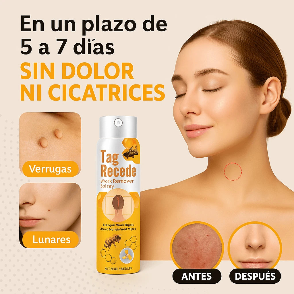 SPRAY TAG RECEDE ELIMINADOR DE VERRUGAS