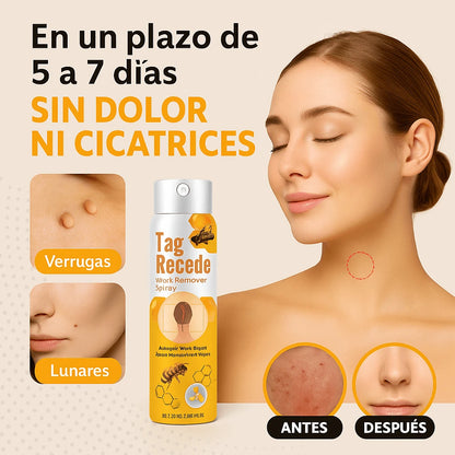 SPRAY TAG RECEDE ELIMINADOR DE VERRUGAS