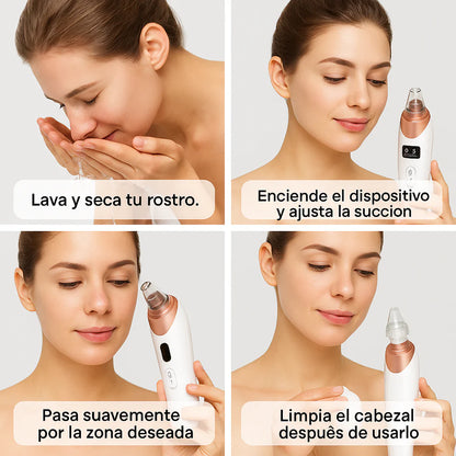 EXTRACTOR PROFESIONAL DE IMPUREZAS Y PUNTOS NEGROS CON CÁMARA HD
