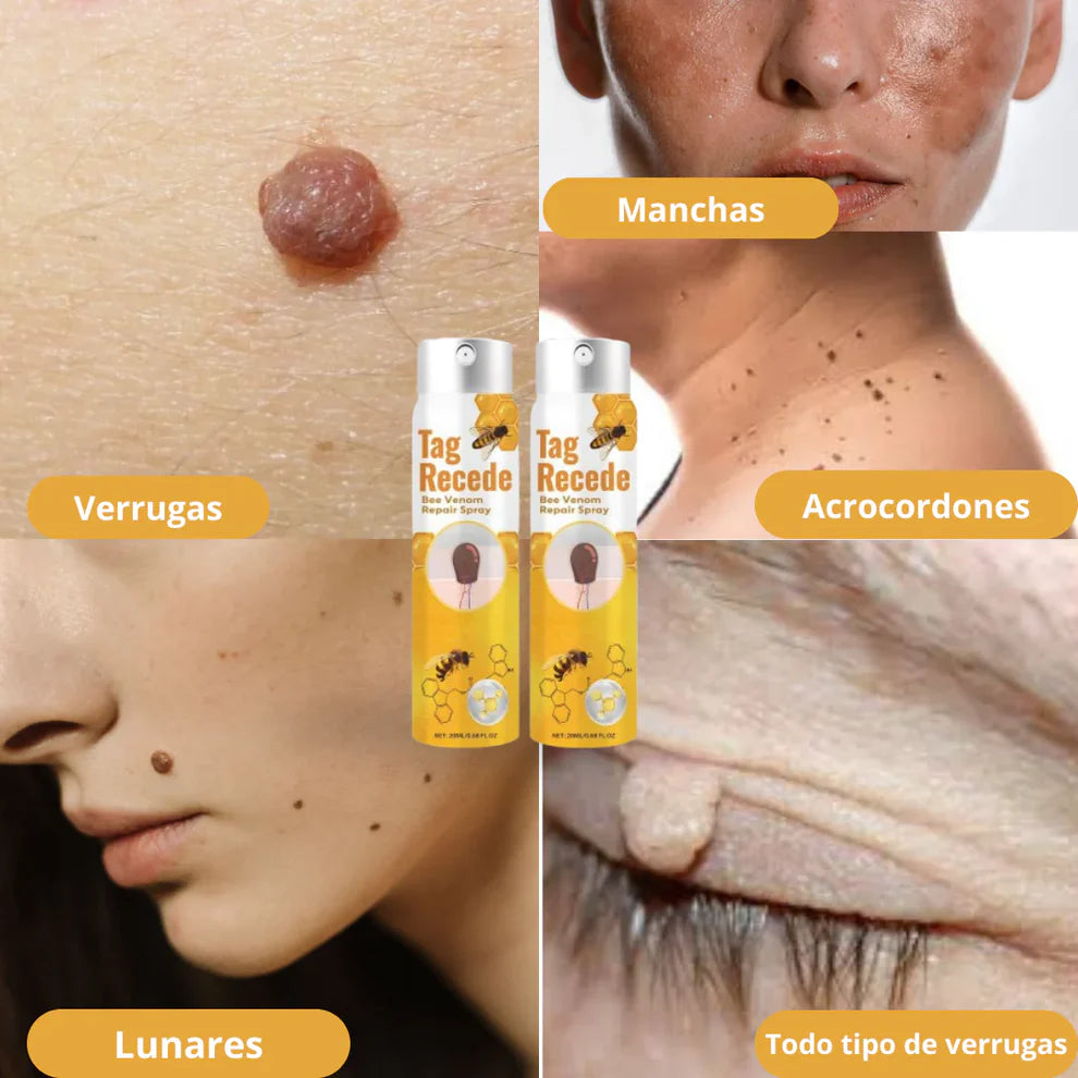 SPRAY TAG RECEDE ELIMINADOR DE VERRUGAS